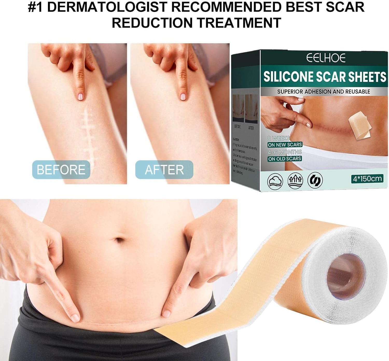 Scar 3